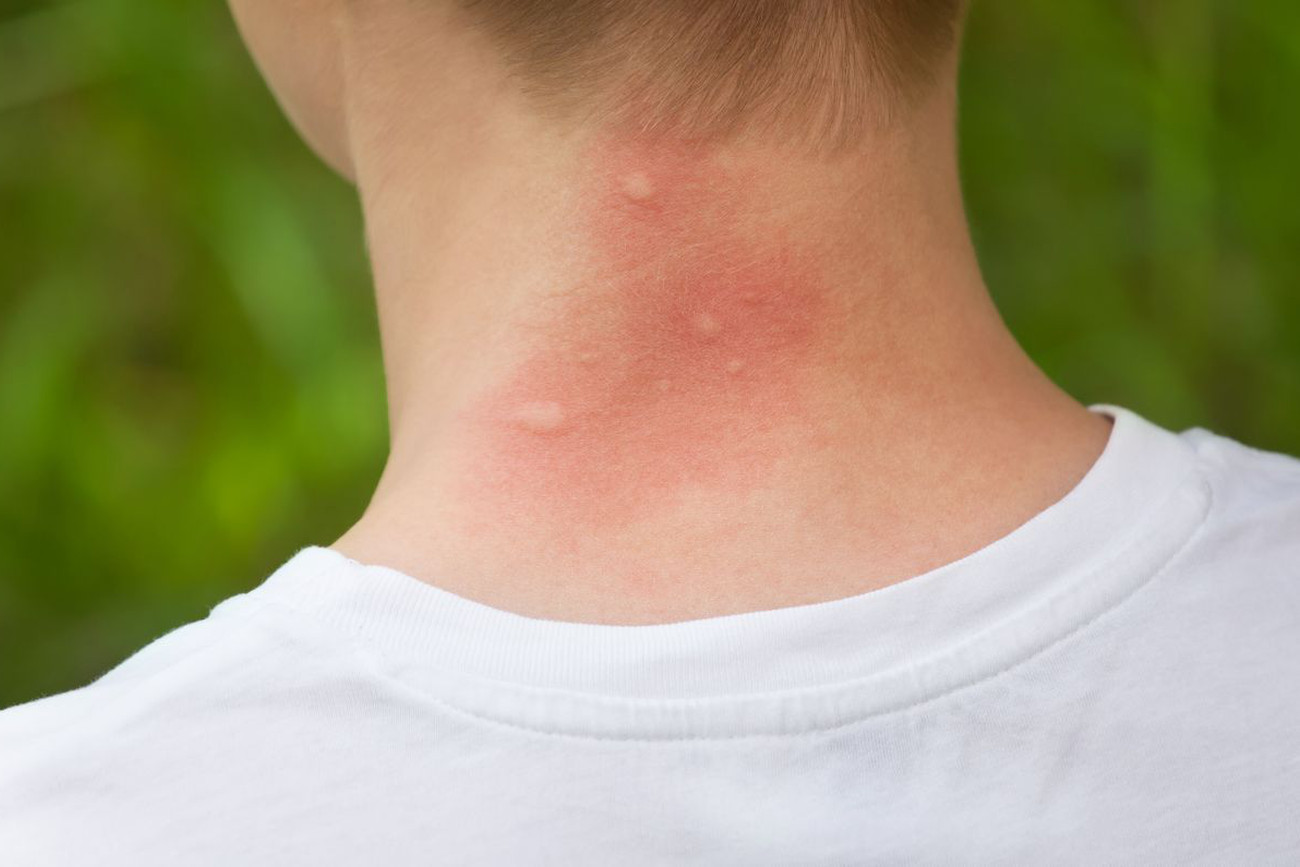dimid_86 / Shutterstock.com