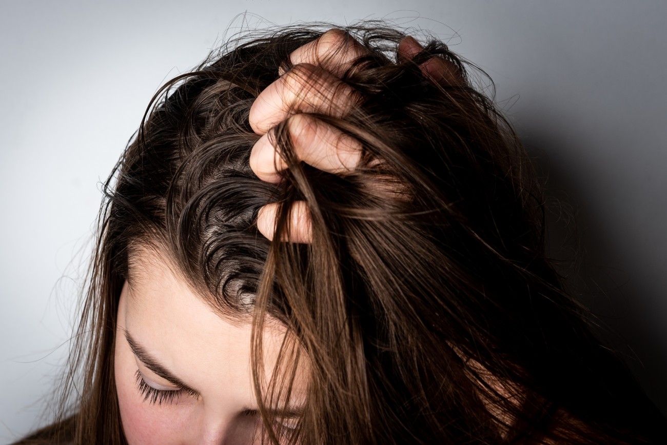 Best Treatments for Scalp Psoriasis – Healthversed
